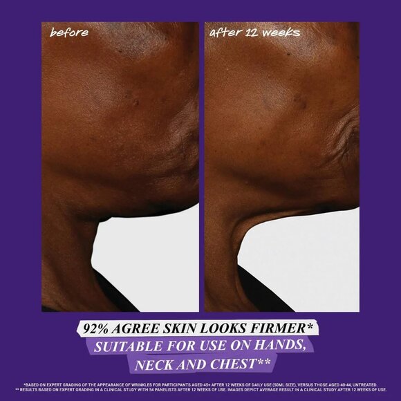 NEW Kiehl's Since 1851 Micro-Dose Anti-Aging Retinol Serum 1.7 oz./100%AUTHENTIC - Picture 4 of 8